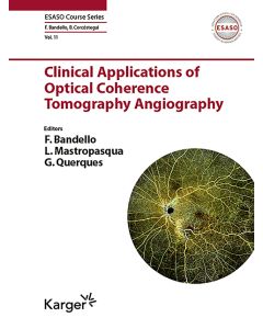Aplicaciones clínicas de la angiografía por tomografía de coherencia óptica