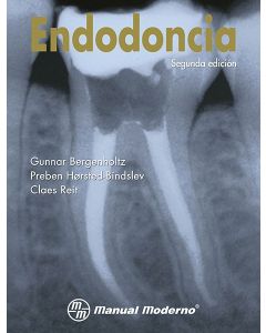 Endodoncia