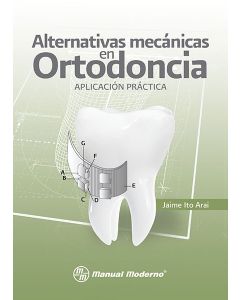 Alternativas mecánicas en ortodoncia.